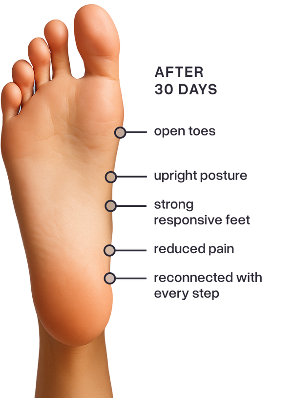 Foot after 30 days with Abstract Chimp