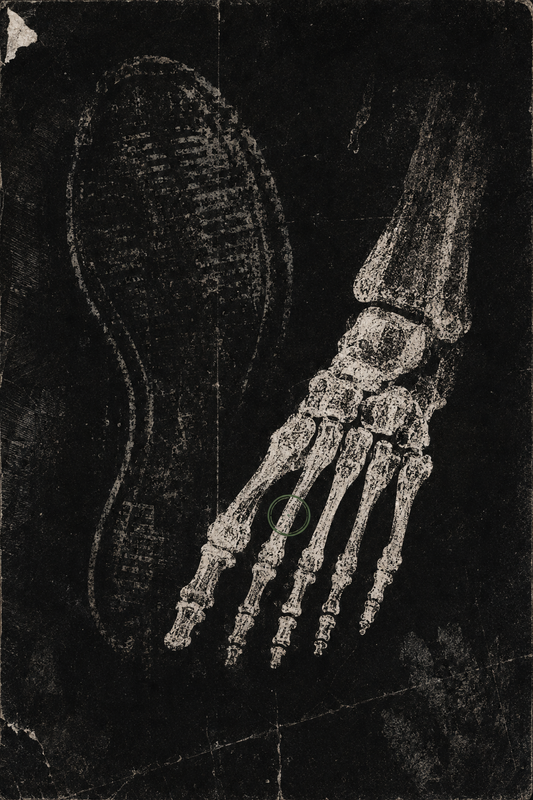Skeletons